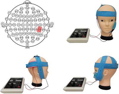 Are People Altruistic When Making Socially Responsible Investments? Evidence From a tDCS Study